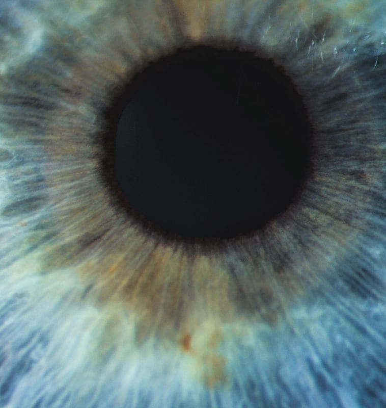 An enlarged image of eye with a blue iris, eyelashes and sclera. Optometrist examination of patient's eye, with a blue iris, eyelashes and sclera.